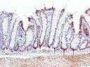figure1.gif
