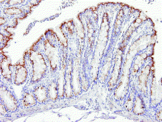 figure2.gif