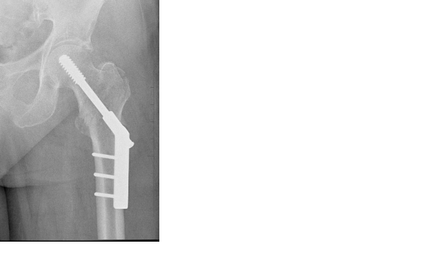hrubina_fig1.gif