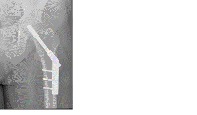 hrubina_fig1.gif