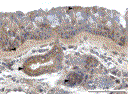 pacova_fig1_26aug09.gif